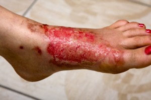 shutterstock_101309467