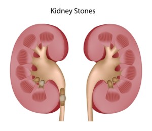 shutterstock_77325922