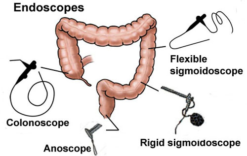 Colon-Endoscopes