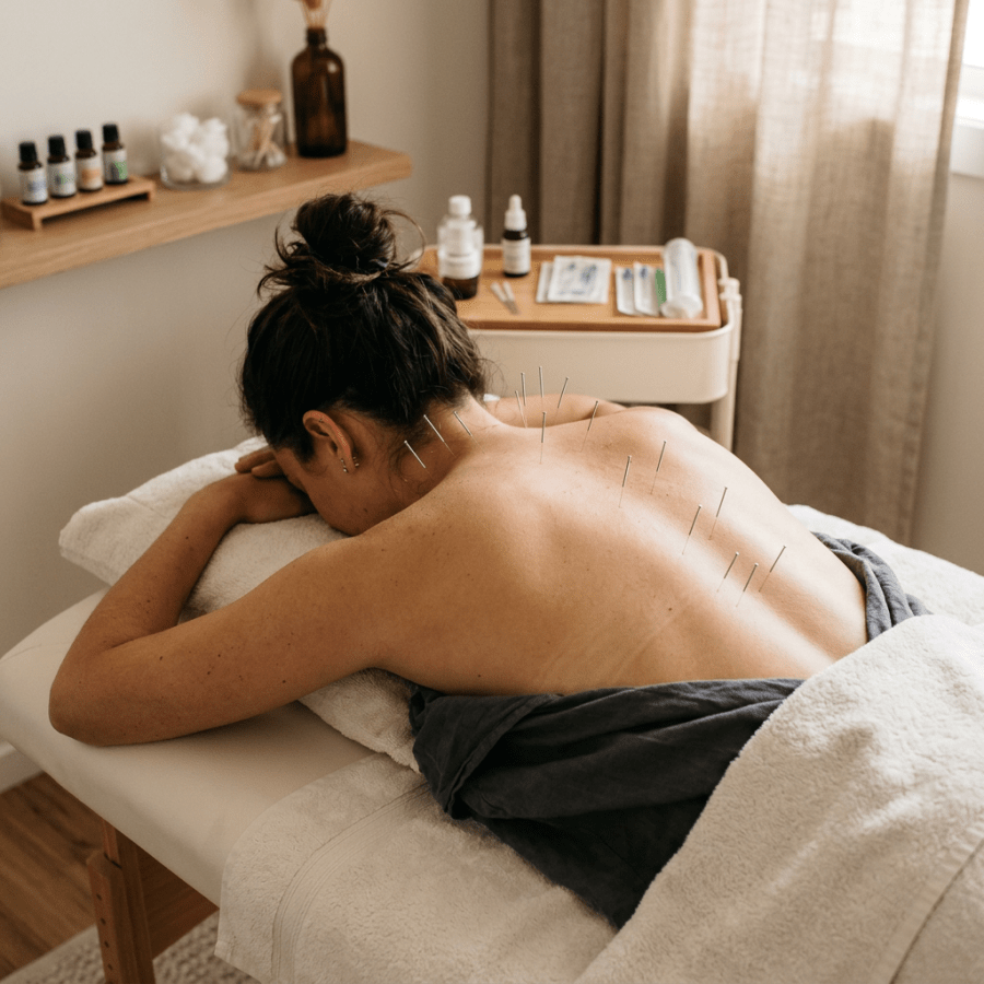 Client lying face down with acupuncture needles placed along the back