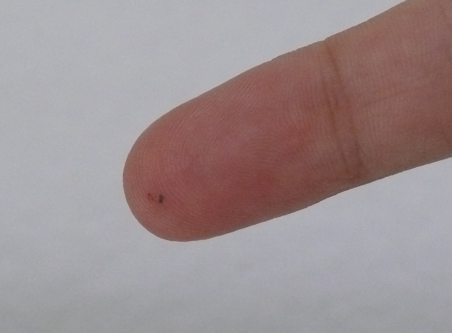 Close-up of a small dark splinter embedded just under the skin of a fingertip